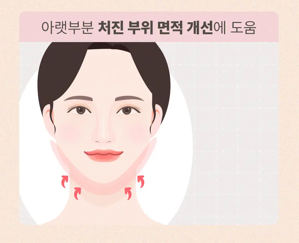 약손명가 브이한 리프팅 패치(PDRN 10K) 5매입 상세페이지 13