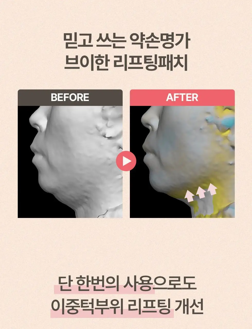 약손명가 브이한 리프팅 패치(PDRN 10K) 5매입 상세페이지 25