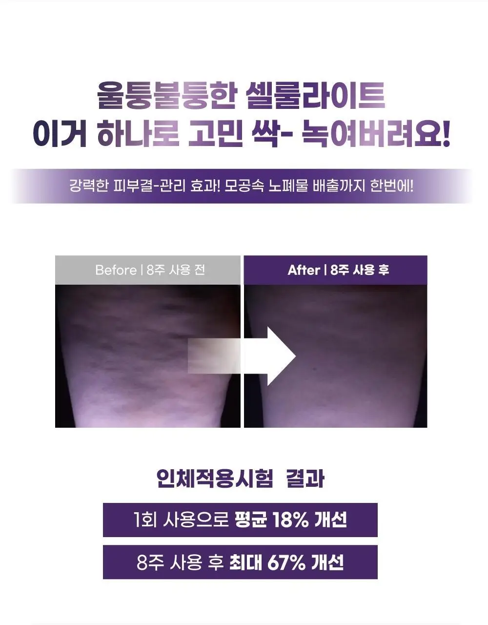 에셀라이트 벨리패치 5.0 18g x 5매 상세페이지 6