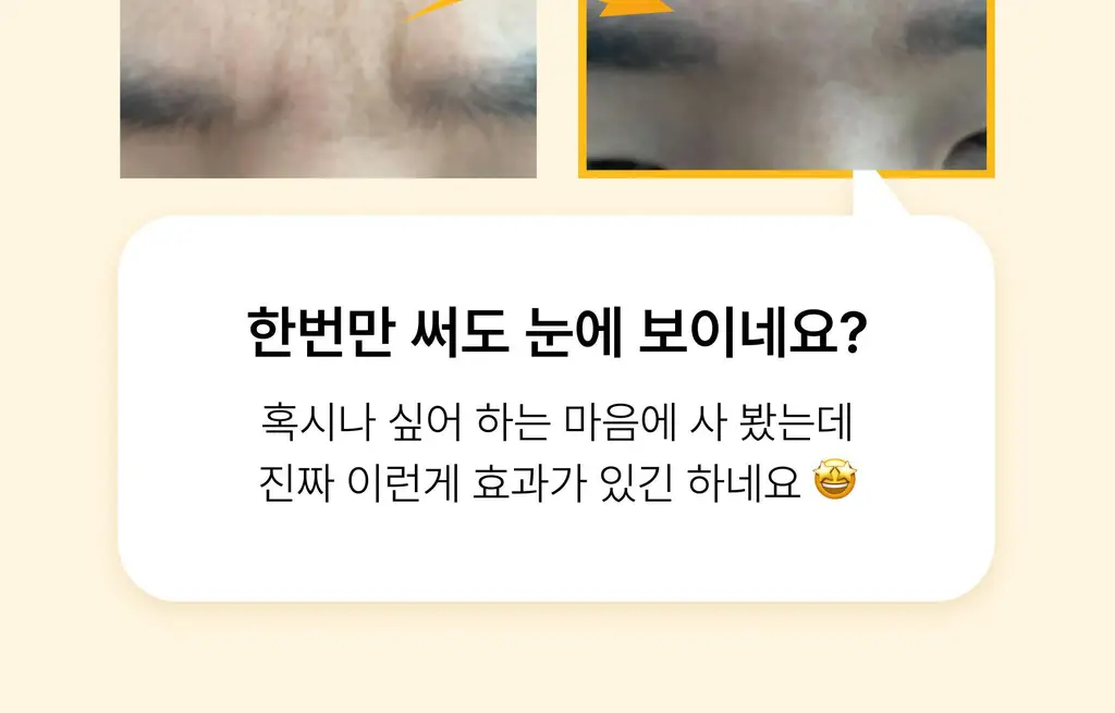 온슬로 레티날 미간주름패치 27매 / 45매입 2종 택 1 상세페이지 86