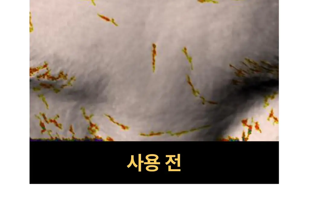 온슬로 레티날 미간주름패치 27매입 상세페이지 40