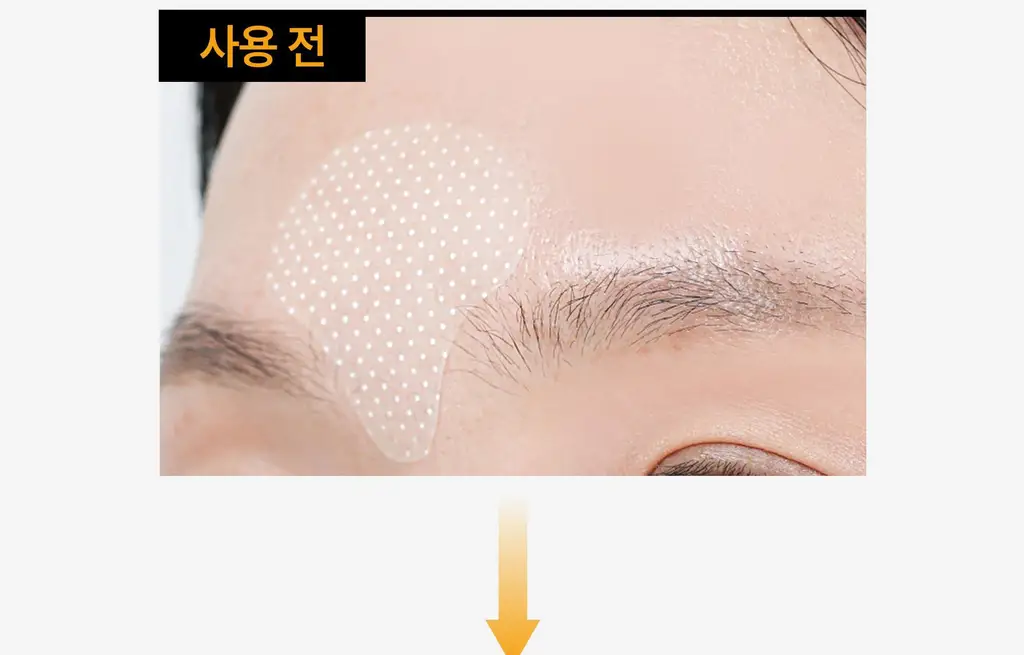 온슬로 레티놀 미간주름패치 45매입 상세페이지 29
