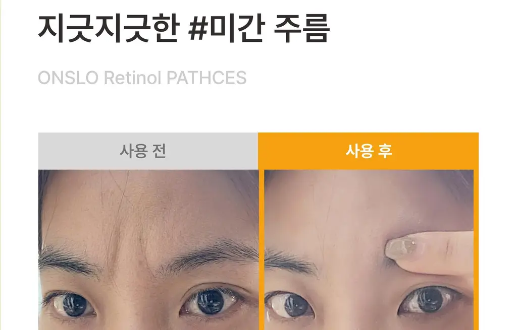 온슬로 레티놀 미간주름패치 45매입 상세페이지 72