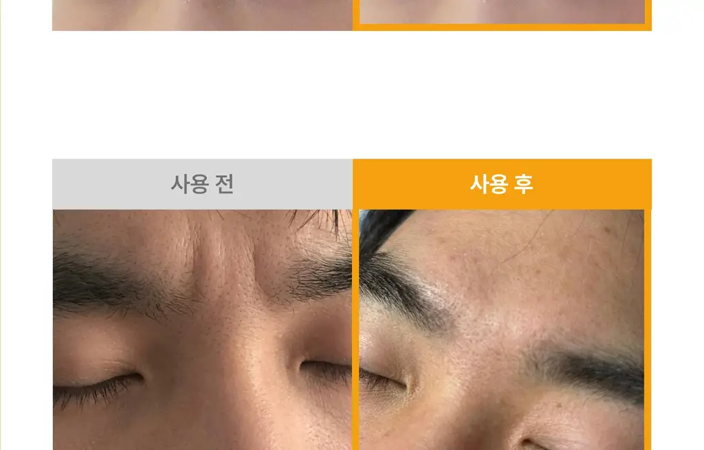 온슬로 레티놀 미간주름패치 45매입 상세페이지 73