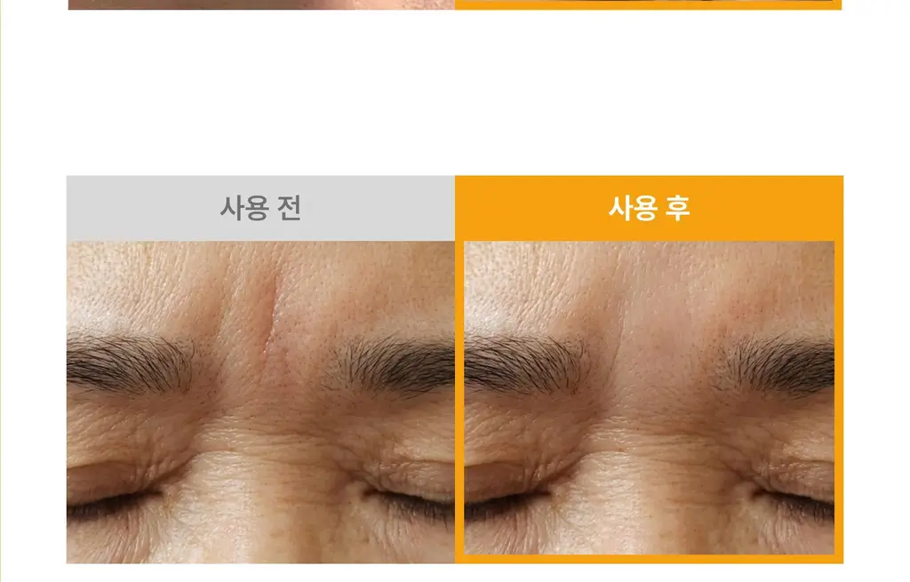 온슬로 레티놀 미간주름패치 45매입 상세페이지 74