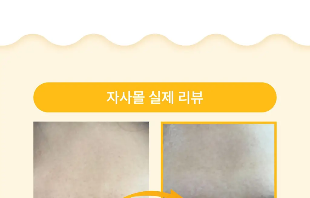 온슬로 레티놀 미간주름패치 45매입 상세페이지 85