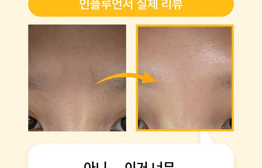 온슬로 레티놀 미간주름패치 45매입 상세페이지 89