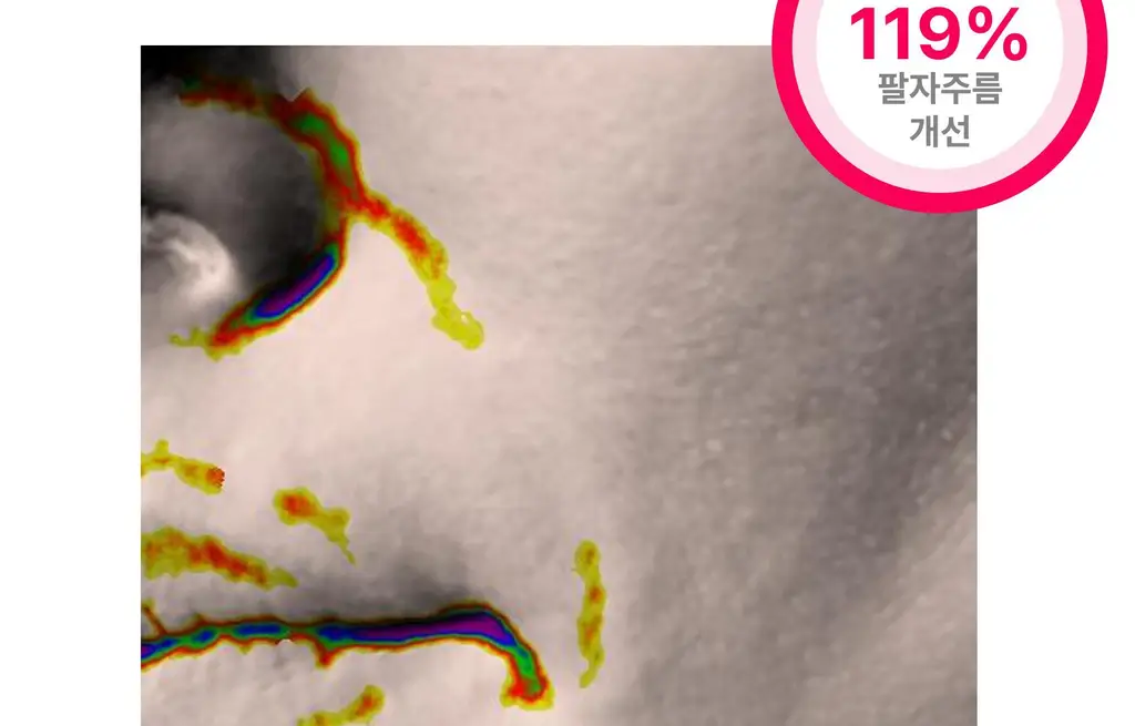 온슬로 레티놀 팔자주름 빅패치 36매 상세페이지 51