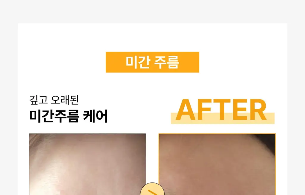 온슬로 주름패치 4종 택1 (미간/팔자/아이) 상세페이지 17