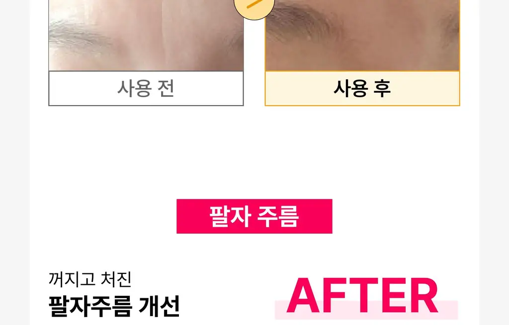 온슬로 주름패치 4종 택1 (미간/팔자/아이) 상세페이지 18