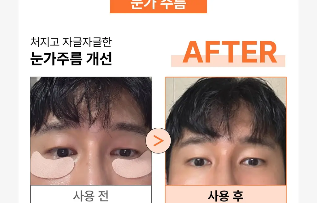 온슬로 주름패치 4종 택1 (미간/팔자/아이) 상세페이지 20