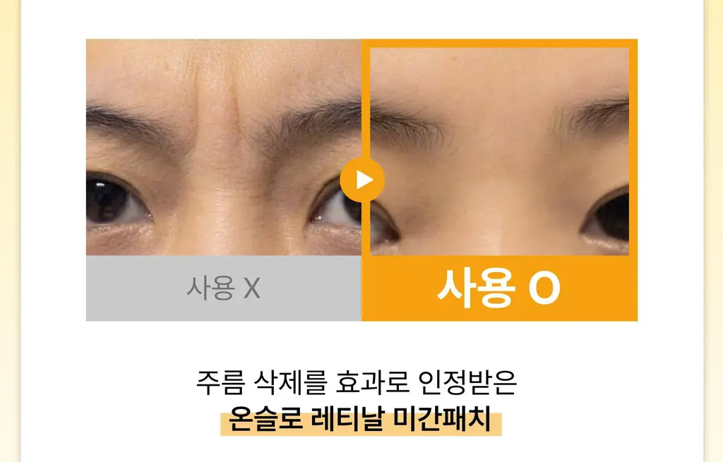 온슬로 주름패치 4종 택1 (미간/팔자/아이) 상세페이지 37