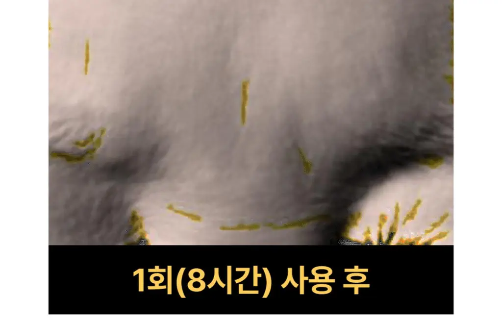 온슬로 주름패치 4종 택1 (미간/팔자/아이) 상세페이지 60