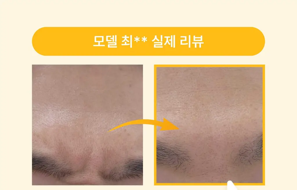 온슬로 주름패치 4종 택1 (미간/팔자/아이) 상세페이지 104