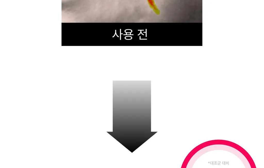 온슬로 주름패치 4종 택1 (미간/팔자/아이) 상세페이지 169