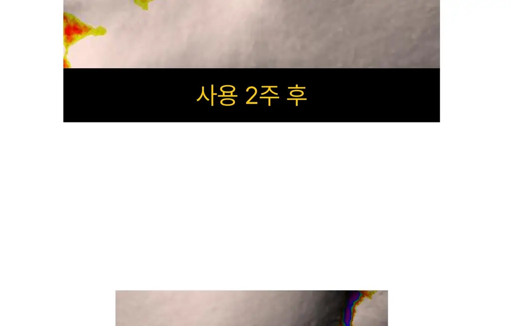 온슬로 주름패치 4종 택1 (미간/팔자/아이) 상세페이지 171
