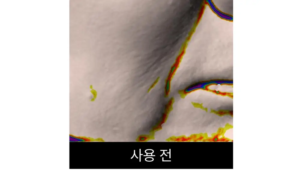 온슬로 주름패치 4종 택1 (미간/팔자/아이) 상세페이지 172