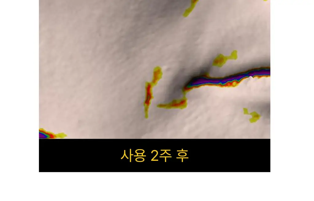 온슬로 주름패치 4종 택1 (미간/팔자/아이) 상세페이지 174