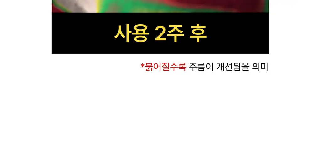 온슬로 주름패치 4종 택1 (미간/팔자/아이) 상세페이지 223