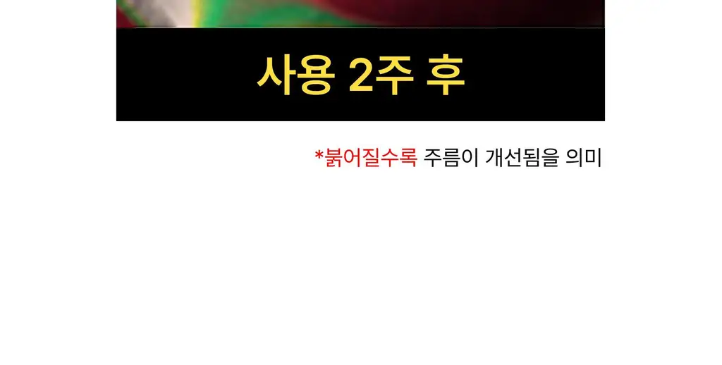 온슬로 피디알엔 아이패치 24매 상세페이지 32