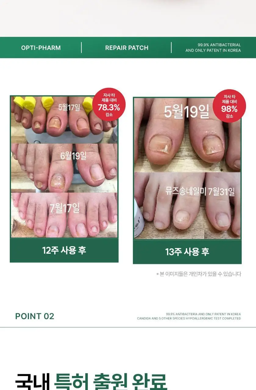옵티팜 네일 리페어 패치 40매 상세페이지 5