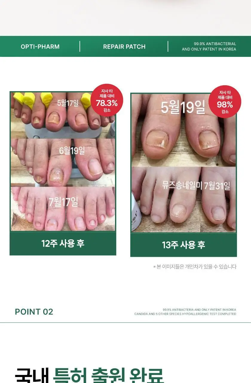 옵티팜 페디 리페어 패치 54매 상세페이지 5