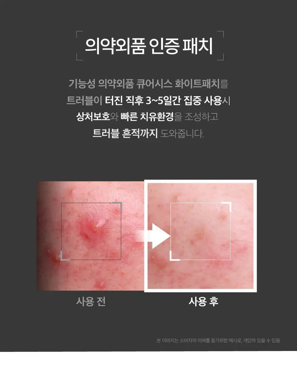큐어시스 나이아신 아크비타 화이트패치 54매 상세페이지 9