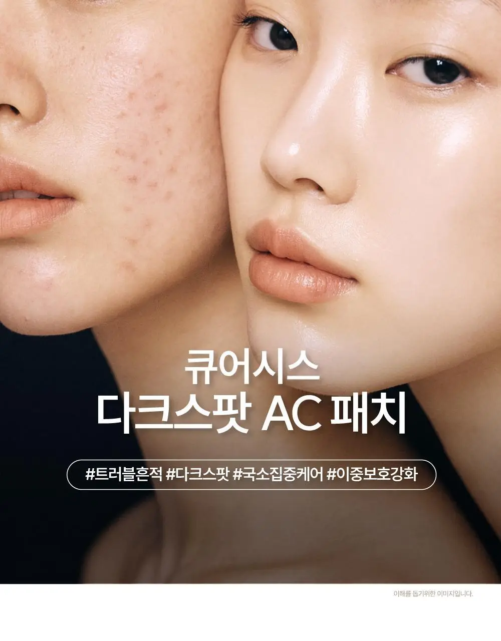 큐어시스 다크 스팟 AC 패치 9매입 상세페이지 2