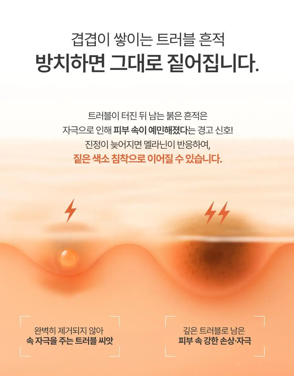큐어시스 다크 스팟 AC 패치 9매입 상세페이지 3